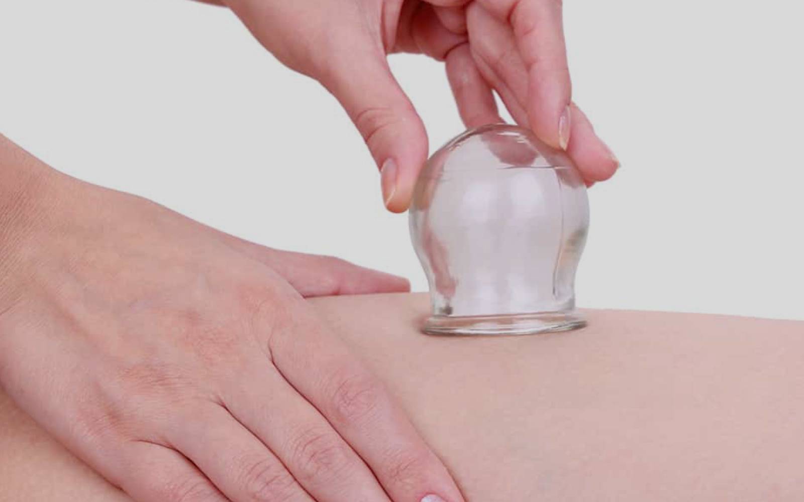 Orthopedic Cupping